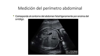 • Corresponde al contorno del abdomen fetal ligeramente por encima del
ombligo.
Medición del perímetro abdominal
 