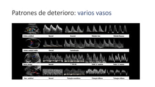 Patrones de deterioro: varios vasos
 