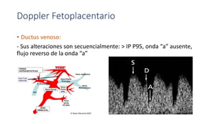 Doppler Fetoplacentario
• Ductus venoso:
- Sus alteraciones son secuencialmente: > IP P95, onda “a” ausente,
flujo reverso de la onda “a”
 
