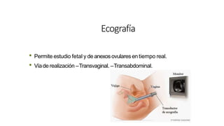 Ecografía
• Permite estudio fetal y de anexosovulares en tiempo real.
• Víade realización –Transvaginal. –Transabdominal.
 