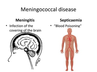 Meningococcal disease
Meningitis
• Infection of the
covering of the brain
Septicaemia
• “Blood Poisoning”
 