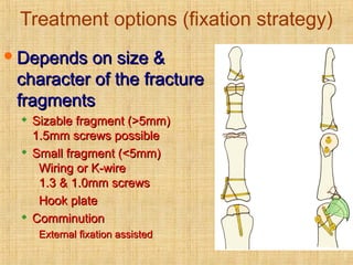 Treatment options (fixation strategy)
Depends on size &Depends on size &
character of the fracturecharacter of the fracture
fragmentsfragments

Sizable fragment (>5mm)Sizable fragment (>5mm)
1.5mm screws possible1.5mm screws possible

Small fragment (<5mm)Small fragment (<5mm)
Wiring or K-wireWiring or K-wire
1.3 & 1.0mm screws1.3 & 1.0mm screws
Hook plateHook plate

ComminutionComminution
External fixation assistedExternal fixation assisted
7
 