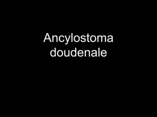 Ancylostoma
doudenale
 