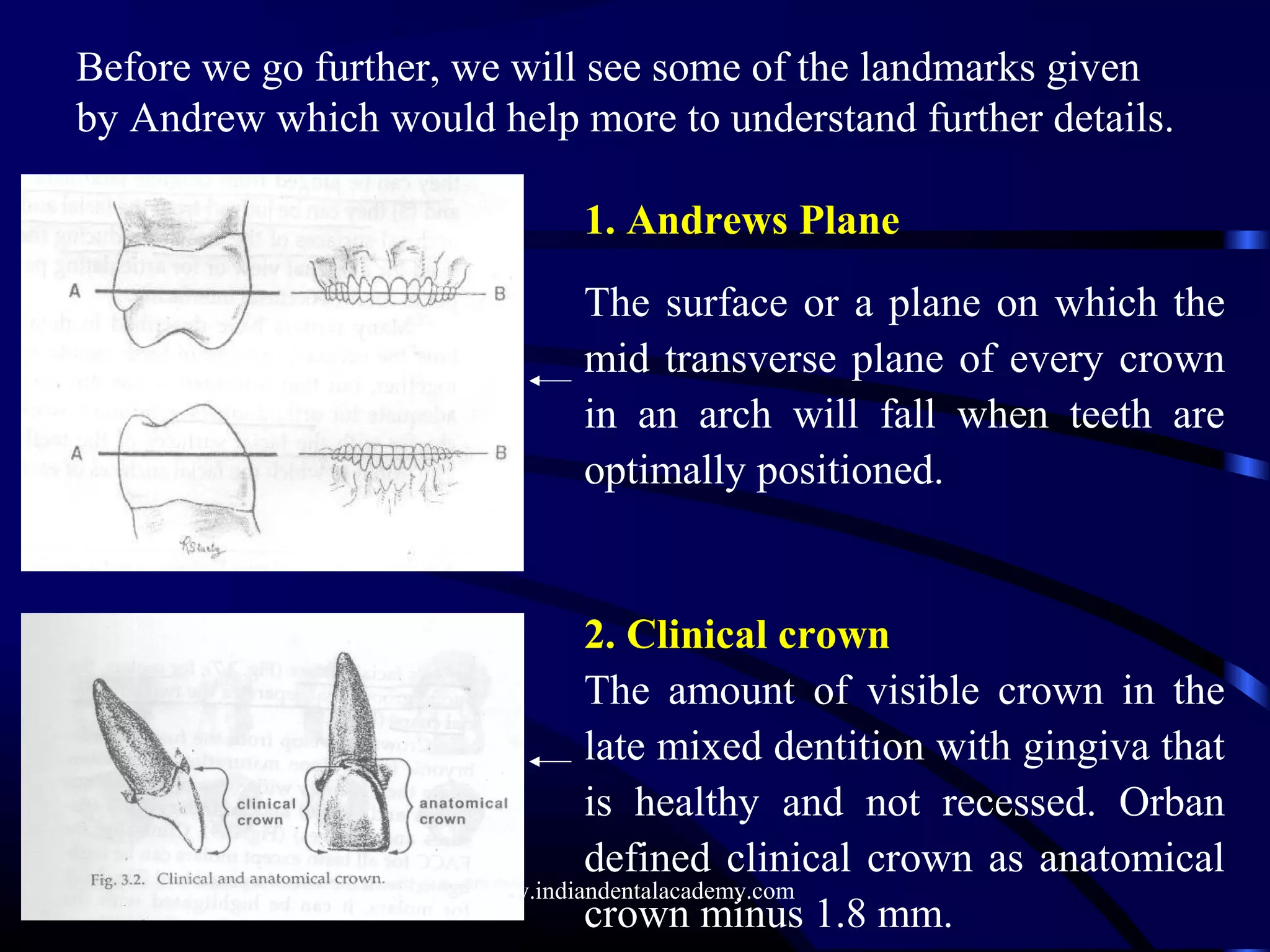 1. Andrews Plane
The surface or a plane on which the
mid transverse plane of every crown
in an arch will fall when teeth are
optimally positioned.
2. Clinical crown
The amount of visible crown in the
late mixed dentition with gingiva that
is healthy and not recessed. Orban
defined clinical crown as anatomical
crown minus 1.8 mm.
Before we go further, we will see some of the landmarks given
by Andrew which would help more to understand further details.
www.indiandentalacademy.com
 