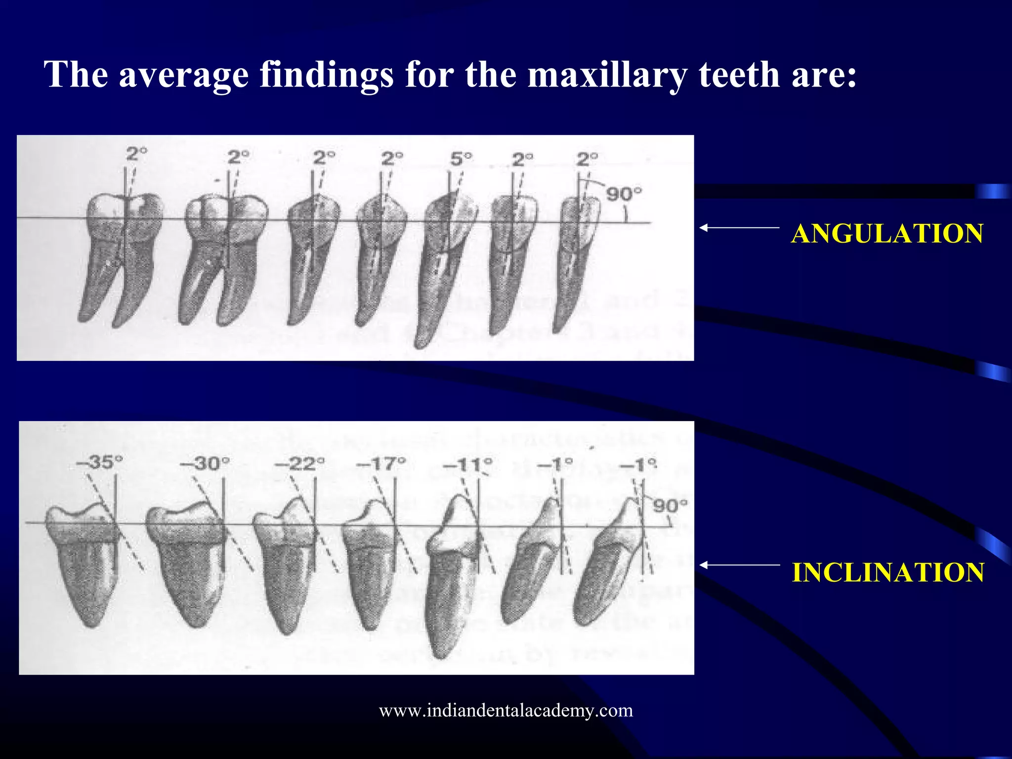 The average findings for the maxillary teeth are:
ANGULATION
INCLINATION
www.indiandentalacademy.com
 