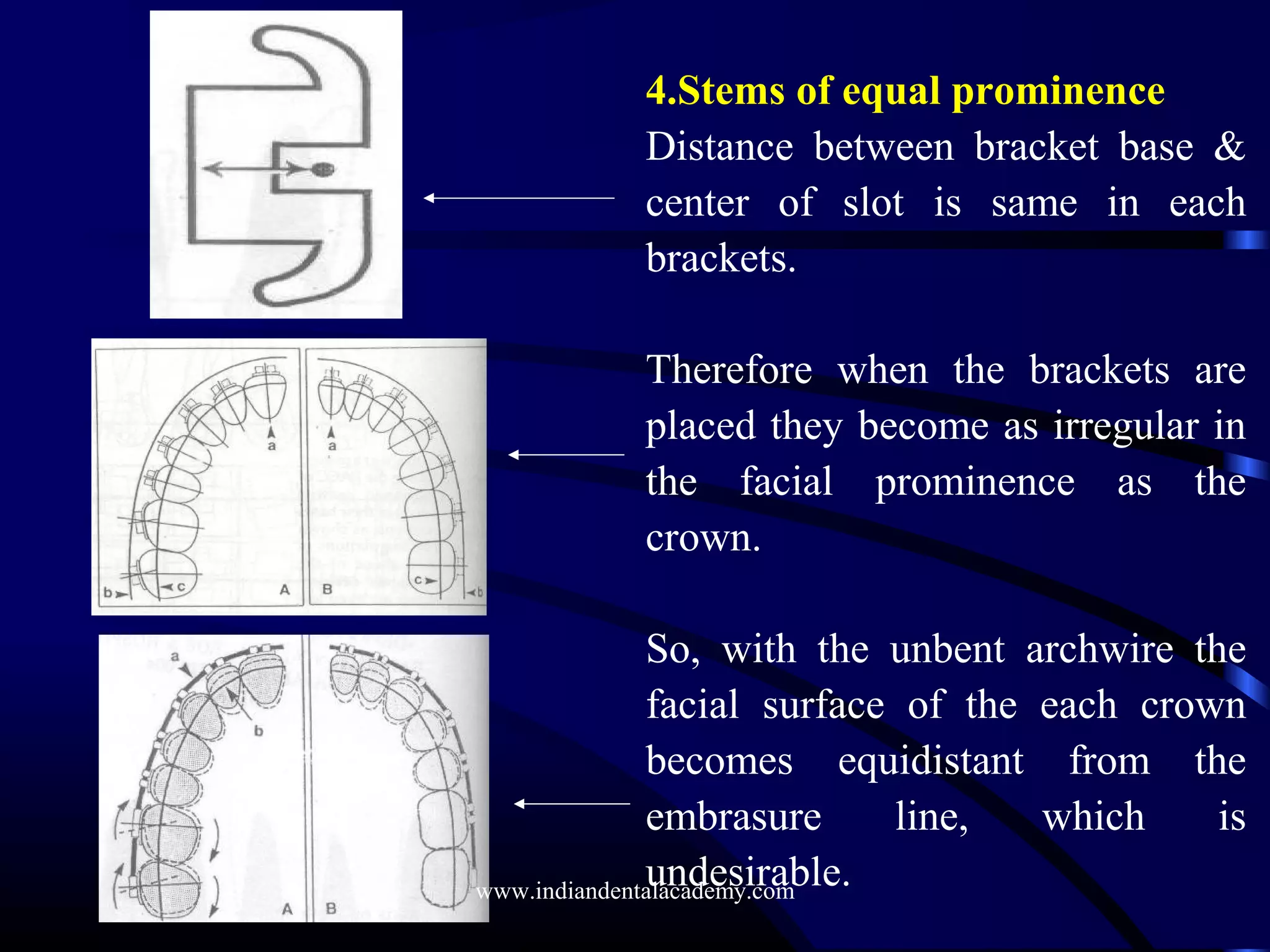 4.Stems of equal prominence
Distance between bracket base &
center of slot is same in each
brackets.
Therefore when the brackets are
placed they become as irregular in
the facial prominence as the
crown.
So, with the unbent archwire the
facial surface of the each crown
becomes equidistant from the
embrasure line, which is
undesirable.www.indiandentalacademy.com
 