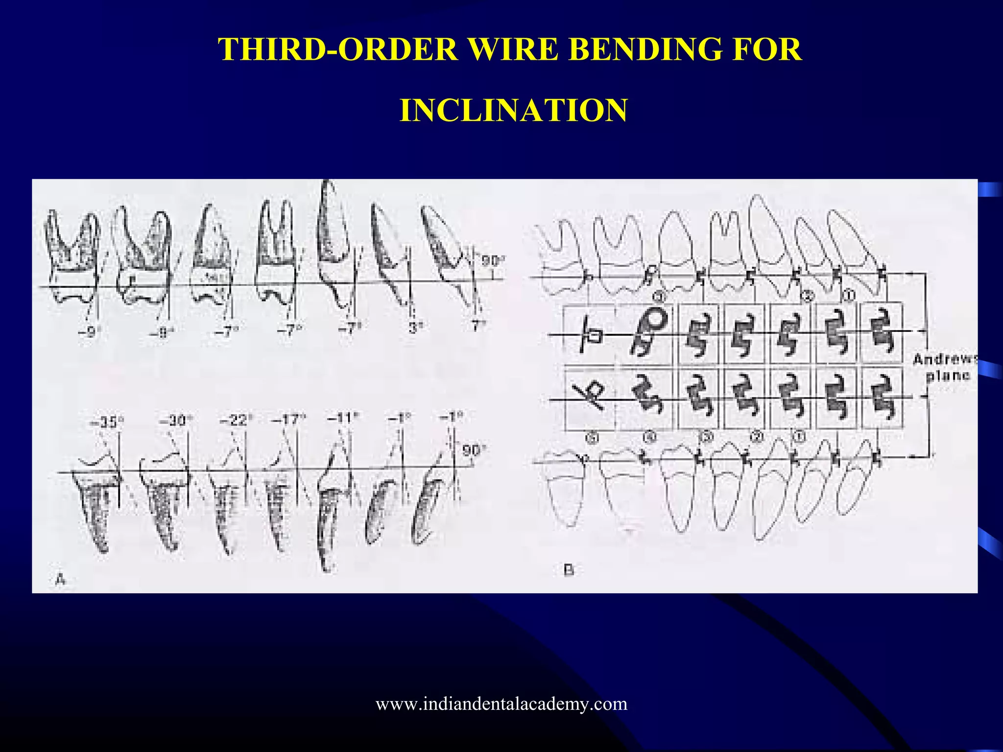 THIRD-ORDER WIRE BENDING FOR
INCLINATION
www.indiandentalacademy.com
 