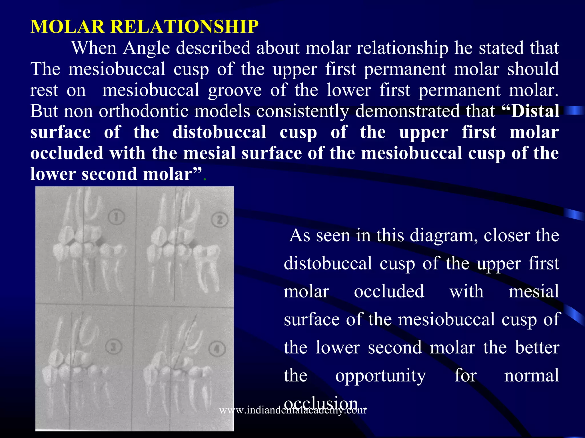 As seen in this diagram, closer the
distobuccal cusp of the upper first
molar occluded with mesial
surface of the mesiobuccal cusp of
the lower second molar the better
the opportunity for normal
occlusion .
MOLAR RELATIONSHIP
When Angle described about molar relationship he stated that
The mesiobuccal cusp of the upper first permanent molar should
rest on mesiobuccal groove of the lower first permanent molar.
But non orthodontic models consistently demonstrated that “Distal
surface of the distobuccal cusp of the upper first molar
occluded with the mesial surface of the mesiobuccal cusp of the
lower second molar”.
www.indiandentalacademy.com
 