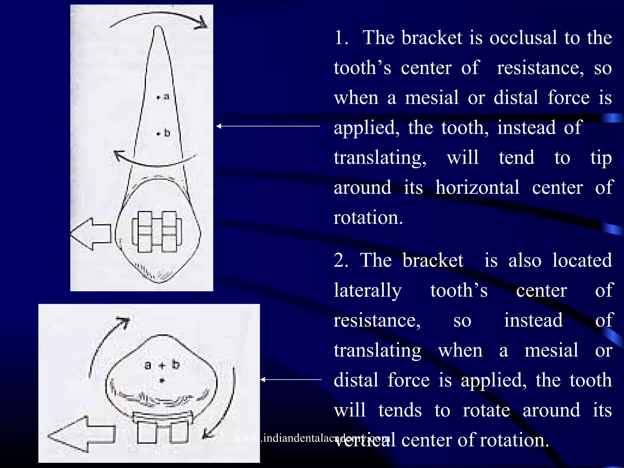 1. The bracket is occlusal to the
tooth’s center of resistance, so
when a mesial or distal force is
applied, the tooth, instead of
translating, will tend to tip
around its horizontal center of
rotation.
2. The bracket is also located
laterally tooth’s center of
resistance, so instead of
translating when a mesial or
distal force is applied, the tooth
will tends to rotate around its
vertical center of rotation.www.indiandentalacademy.com
 