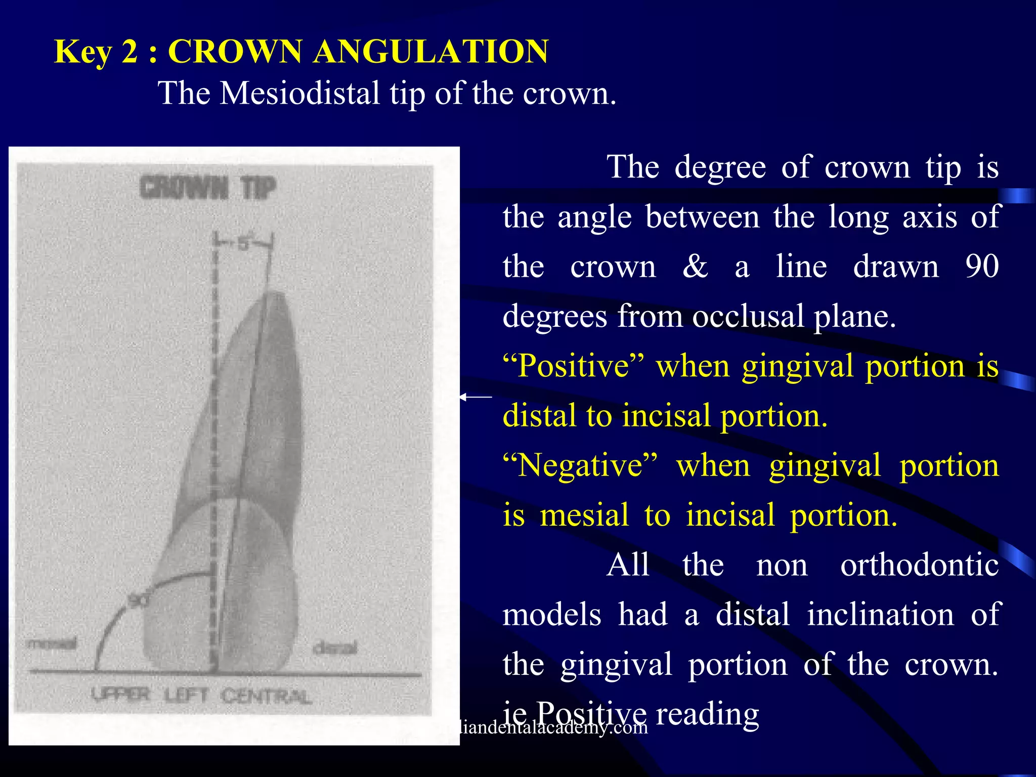 Key 2 : CROWN ANGULATION
The Mesiodistal tip of the crown.
The degree of crown tip is
the angle between the long axis of
the crown & a line drawn 90
degrees from occlusal plane.
“Positive” when gingival portion is
distal to incisal portion.
“Negative” when gingival portion
is mesial to incisal portion.
All the non orthodontic
models had a distal inclination of
the gingival portion of the crown.
ie Positive readingwww.indiandentalacademy.com
 