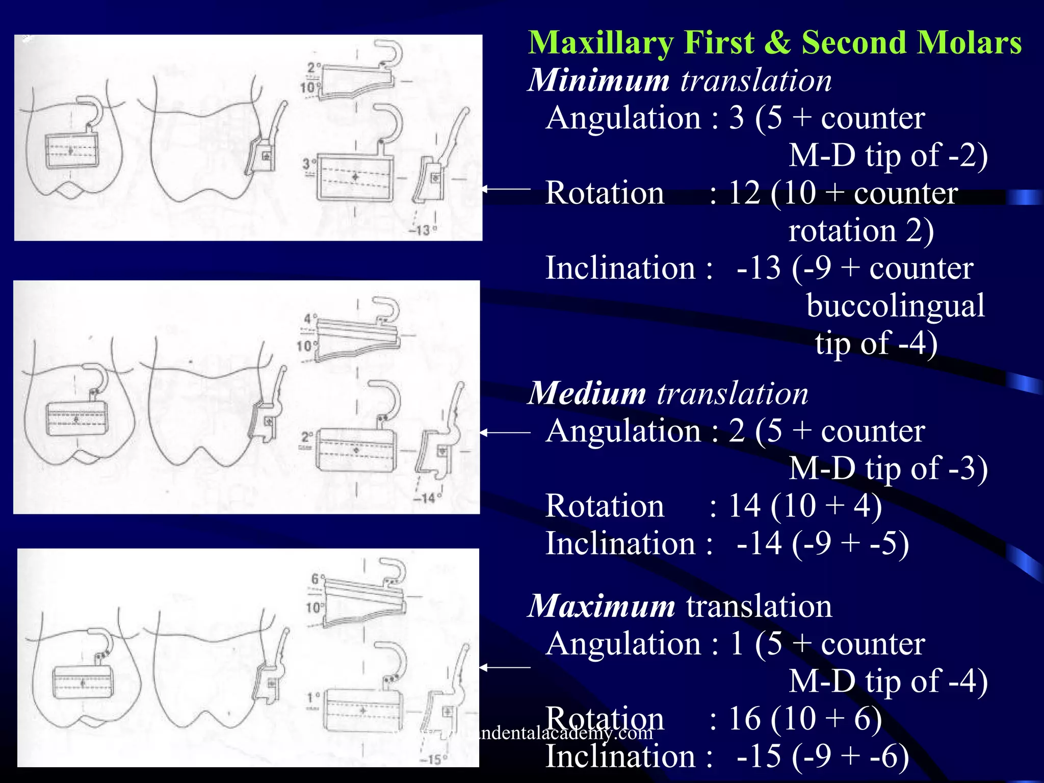 Maxillary First & Second Molars
Minimum translation
Angulation : 3 (5 + counter
M-D tip of -2)
Rotation : 12 (10 + counter
rotation 2)
Inclination : -13 (-9 + counter
buccolingual
tip of -4)
Medium translation
Angulation : 2 (5 + counter
M-D tip of -3)
Rotation : 14 (10 + 4)
Inclination : -14 (-9 + -5)
Maximum translation
Angulation : 1 (5 + counter
M-D tip of -4)
Rotation : 16 (10 + 6)
Inclination : -15 (-9 + -6)
www.indiandentalacademy.com
 