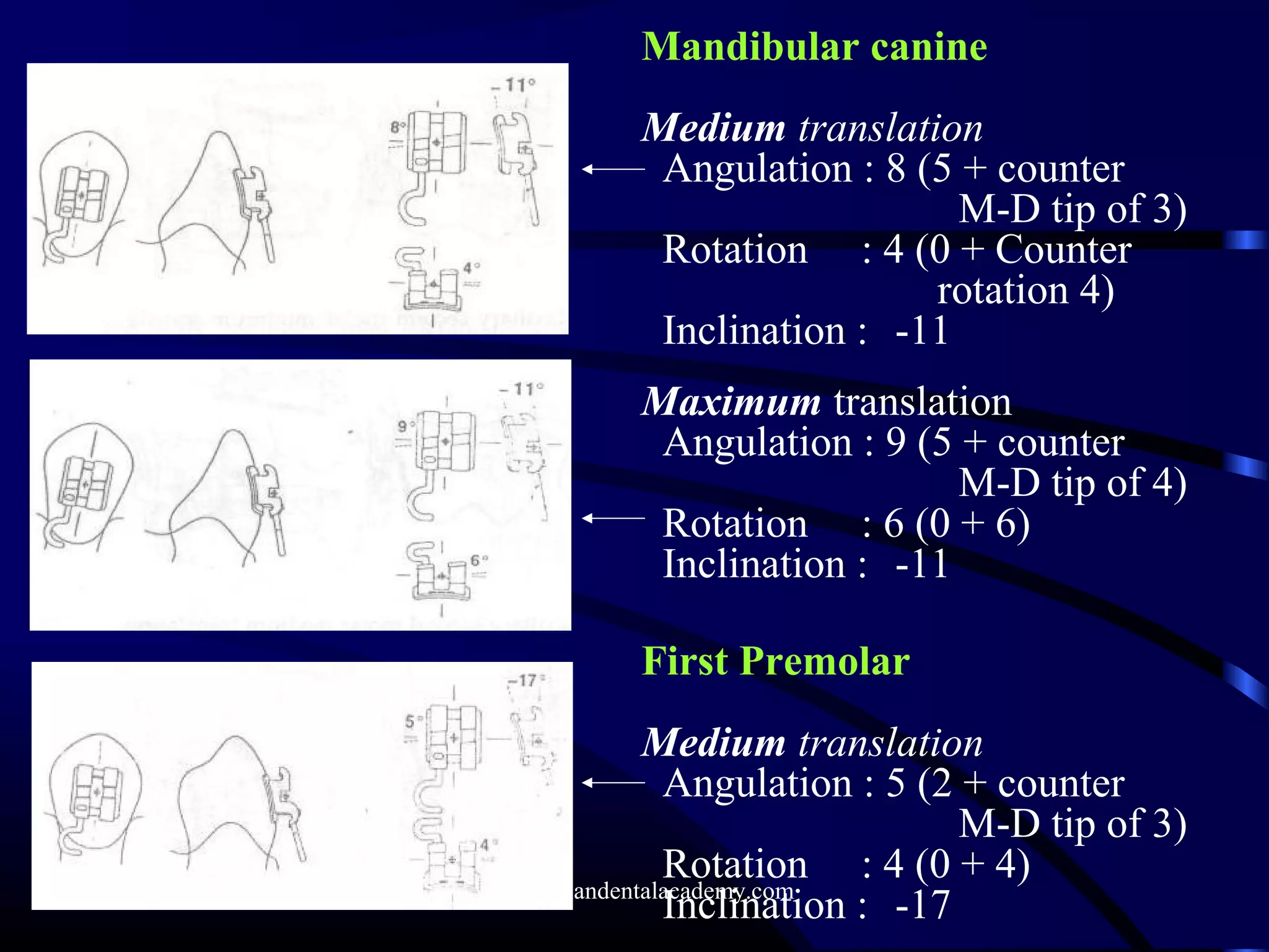 Mandibular canine
Medium translation
Angulation : 8 (5 + counter
M-D tip of 3)
Rotation : 4 (0 + Counter
rotation 4)
Inclination : -11
Maximum translation
Angulation : 9 (5 + counter
M-D tip of 4)
Rotation : 6 (0 + 6)
Inclination : -11
First Premolar
Medium translation
Angulation : 5 (2 + counter
M-D tip of 3)
Rotation : 4 (0 + 4)
Inclination : -17www.indiandentalacademy.com
 