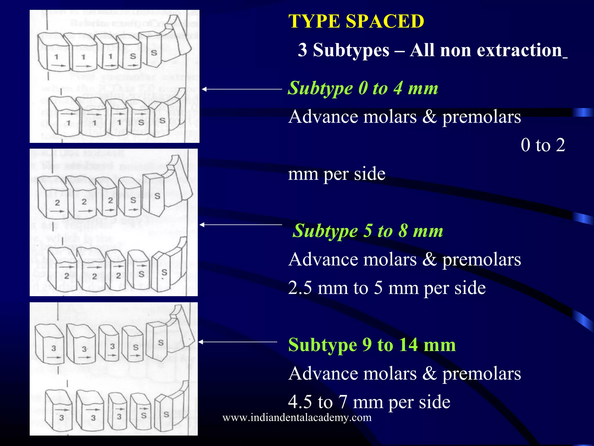 TYPE SPACED
3 Subtypes – All non extraction
Subtype 0 to 4 mm
Advance molars & premolars
0 to 2
mm per side
Subtype 5 to 8 mm
Advance molars & premolars
2.5 mm to 5 mm per side
Subtype 9 to 14 mm
Advance molars & premolars
4.5 to 7 mm per side
www.indiandentalacademy.com
 