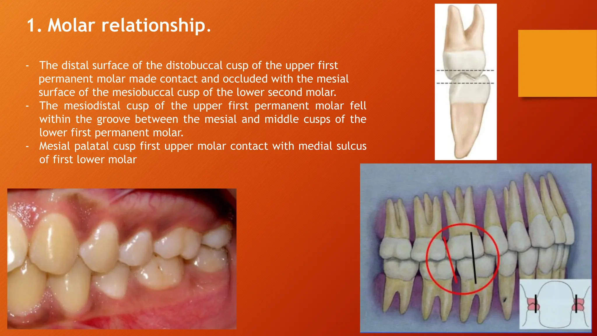 Andrews's six keys of ideal occlusion.pptx