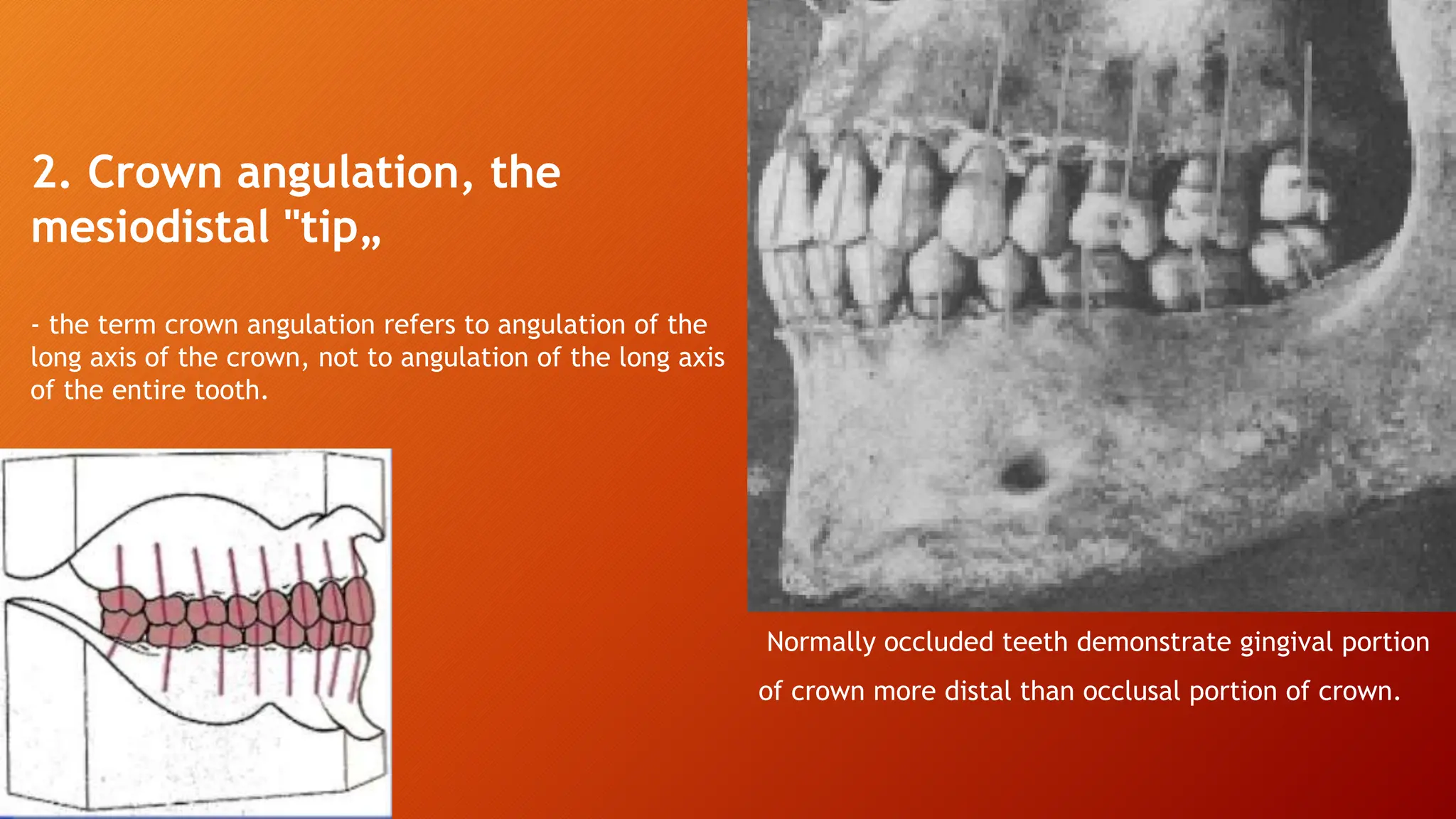 Andrews's six keys of ideal occlusion.pptx