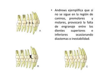 Andrews ejemplifica que si no se sigue en la región de caninos, premolares  y molares, provocará la falta de engranaje entre los dientes superiores e inferiores ocasionando diastemas o inestabilidad. 