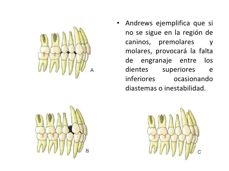 Andrews llaves