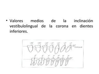 • Valores
medios
de
la
inclinación
vestibulolingual de la corona en dientes
inferiores.

 