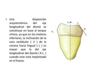 disposición
• Una
arquitectónica
del
eje
longitudinal del diente se
constituye en base al torque
clínico, ya que en los molares
inferiores, la inclinación de la
cara vestibular ( V ) de la
corona hacia lingual ( L ) es
mayor que la del eje
longitudinal del diente ( E.L. )
cuando este está implantado
en el hueso.

 