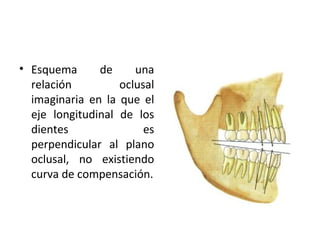 • Esquema
de
una
relación
oclusal
imaginaria en la que el
eje longitudinal de los
dientes
es
perpendicular al plano
oclusal, no existiendo
curva de compensación.

 