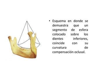 • Esquema en donde se
demuestra que un
segmento de esfera
colocado sobre los
dientes
inferiores,
coincide
con
su
curvatura
de
compensación oclusal.

 