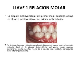 LLAVE 1 RELACION MOLAR
• La cúspide mesiovestibular del primer molar superior, ocluye
en el surco mesiovestibular del primer molar inferior.

 Por lo tanto, la mejor indicación para la oclusión normal, es que exista el contacto
vertiente distal de la cúspide distovestibular del primer molar superior
permanente, con la superficie mesial de la cúspide mesiovestibular del segundo
molar inferior permanente.
.

 