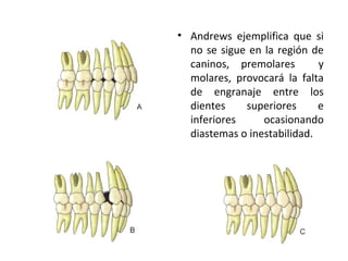 • Andrews ejemplifica que si
no se sigue en la región de
caninos, premolares
y
molares, provocará la falta
de engranaje entre los
dientes
superiores
e
inferiores
ocasionando
diastemas o inestabilidad.

 