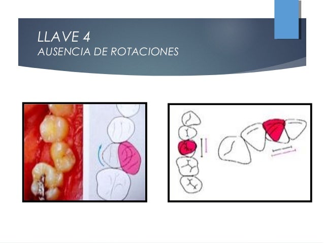 AJUSTE OCLUSAL Y LLAVES DE ANDREWS