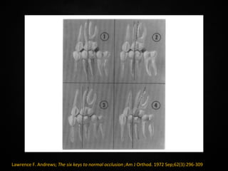 Andrew's Six Keys | PPT
