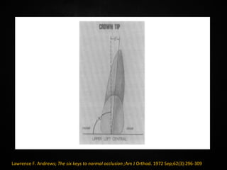 Andrew's Six Keys | PPT
