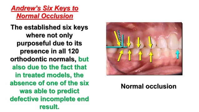 Andrew’s six keys of normal occlusion | PPTX | Dental Health | Diseases and Conditions