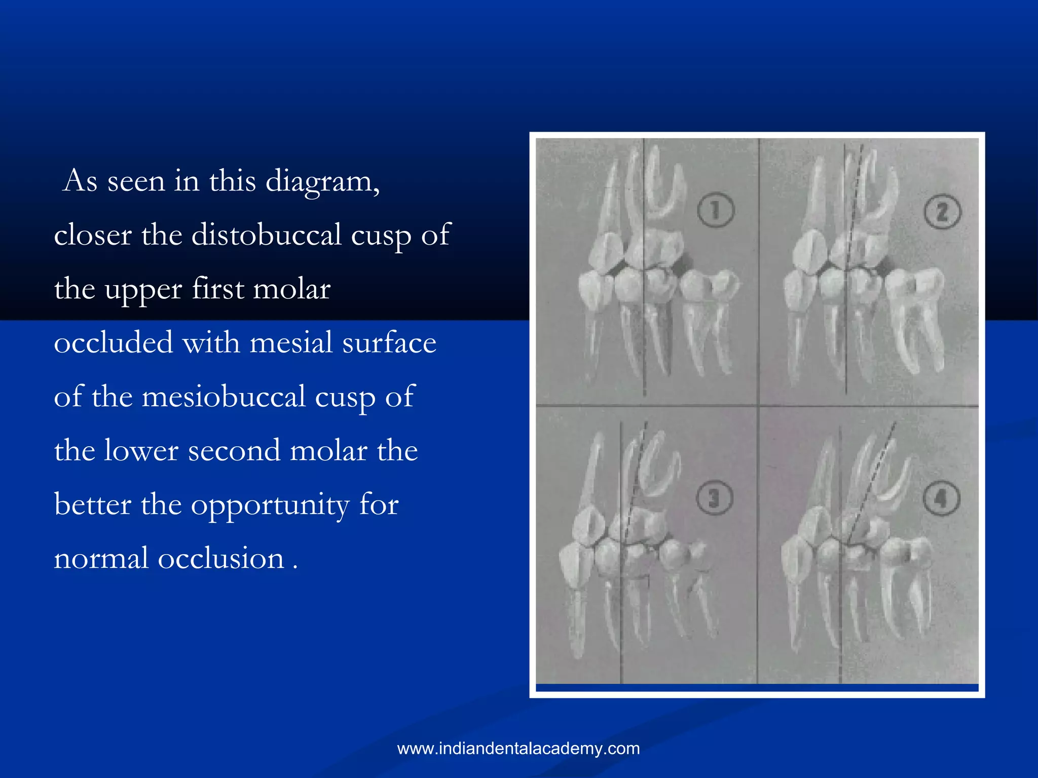 As seen in this diagram,
closer the distobuccal cusp of
the upper first molar
occluded with mesial surface
of the mesiobuccal cusp of
the lower second molar the
better the opportunity for
normal occlusion .
www.indiandentalacademy.com
 
