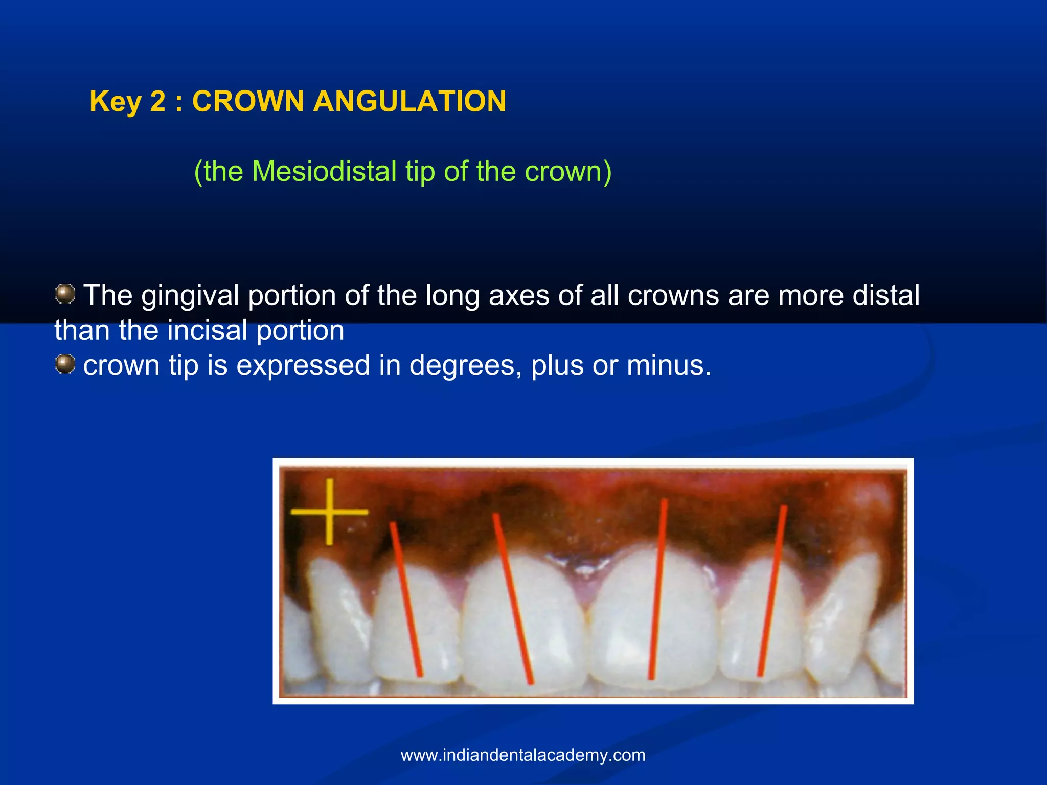 Andrews six keys of occlusion / certified fixed orthodontics courses in india PPT