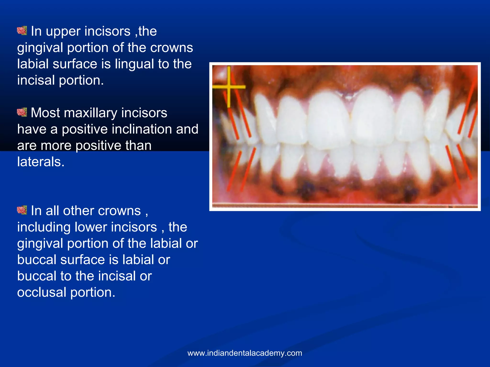 In upper incisors ,the
gingival portion of the crowns
labial surface is lingual to the
incisal portion.
Most maxillary incisors
have a positive inclination and
are more positive than
laterals.
In all other crowns ,
including lower incisors , the
gingival portion of the labial or
buccal surface is labial or
buccal to the incisal or
occlusal portion.
www.indiandentalacademy.com
 