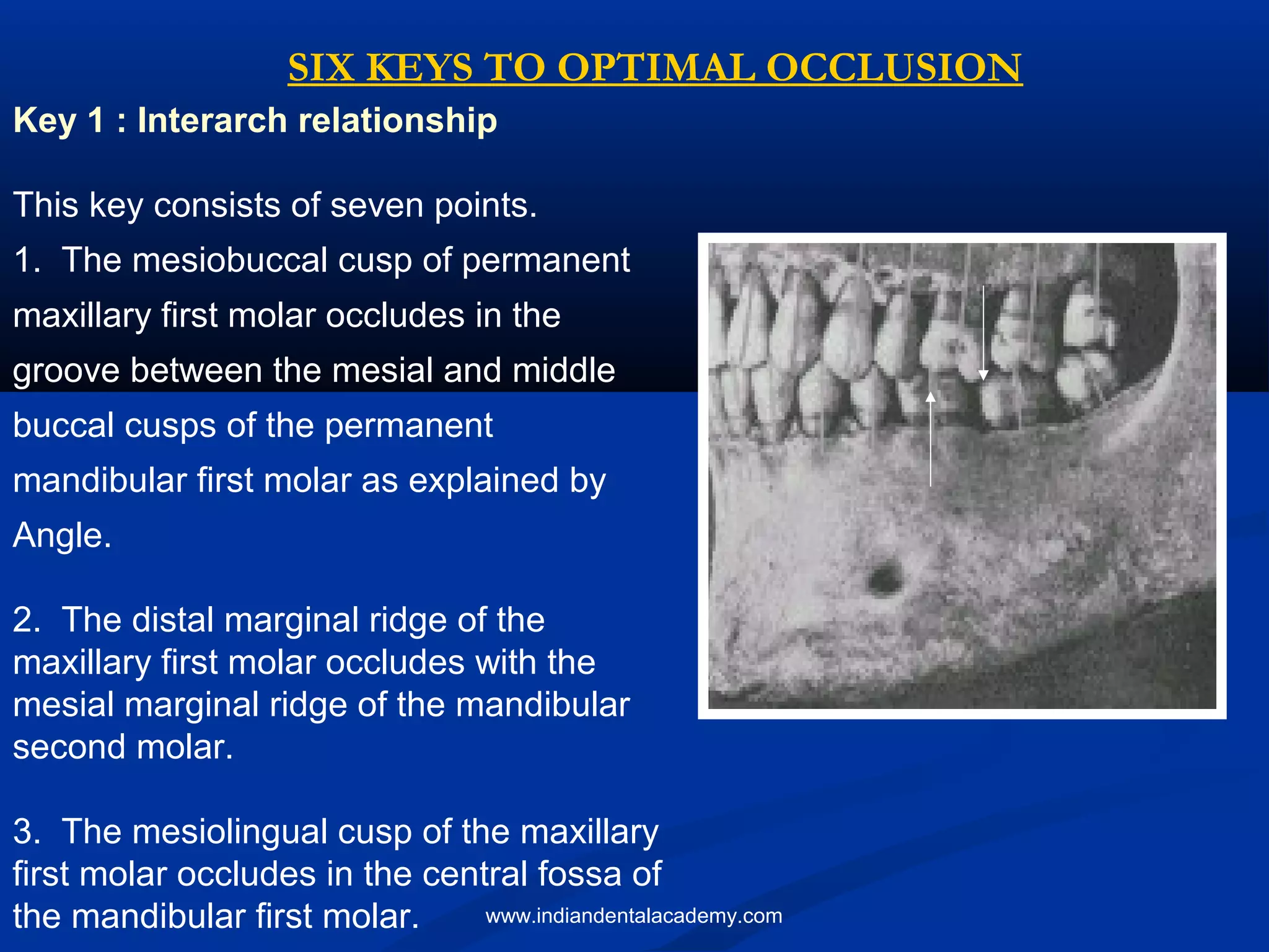 Key 1 : Interarch relationship
This key consists of seven points.
1. The mesiobuccal cusp of permanent
maxillary first molar occludes in the
groove between the mesial and middle
buccal cusps of the permanent
mandibular first molar as explained by
Angle.
2. The distal marginal ridge of the
maxillary first molar occludes with the
mesial marginal ridge of the mandibular
second molar.
3. The mesiolingual cusp of the maxillary
first molar occludes in the central fossa of
the mandibular first molar.
SIX KEYS TO OPTIMAL OCCLUSION
www.indiandentalacademy.com
 