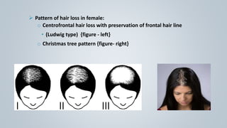 Female-Pattern Hair Loss - Hair By Dr. Max, Restoration Center