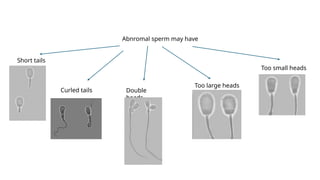 Comprehensive Guide to Diagnosing and Treating Prostatitis and ...