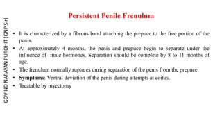 Persistent Penile Frenulum
• It is characterized by a fibrous band attaching the prepuce to the free portion of the
penis.
• At approximately 4 months, the penis and prepuce begin to separate under the
influence of male hormones. Separation should be complete by 8 to 11 months of
age.
• The frenulum normally ruptures during separation of the penis from the prepuce
• Symptoms: Ventral deviation of the penis during attempts at coitus.
• Treatable by myectomy
GOVIND
NARAYAN
PUROHIT
(GNP
Sir)
 