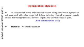 Pigmentation Melanosis
 Its characterzied by the entire urethral mucosa having dark brown pigmentaion
and associated with other congenital defects including bilateral segmental gonadal
aplasia, bilateral spermiostasis, fusion of ampulla and fusion of vesicular gland.
(Blom and christensen, 1972)
 Treatment : No specific treatment
GOVIND
NARAYAN
PUROHIT
(GNP
Sir)
 