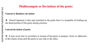 Phallocampsis or Deviations of the penis:
Ventral or Rainbow deviation
 Dorsal ligament is thin and stretched to the point that it is incapable of holding up
the distal portion of the penis during erection.
Lateral deviation of penis
 It may occur due to secondary to trauma of the penis or prepuce. Scars or adhesions
of the elastic tissue pull the penis to one side or the other.
GOVIND
NARAYAN
PUROHIT
(GNP
Sir)
 