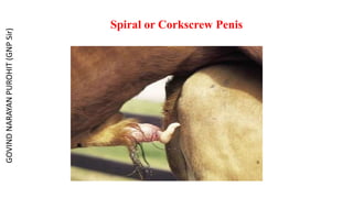 Spiral or Corkscrew Penis
GOVIND
NARAYAN
PUROHIT
(GNP
Sir)
 