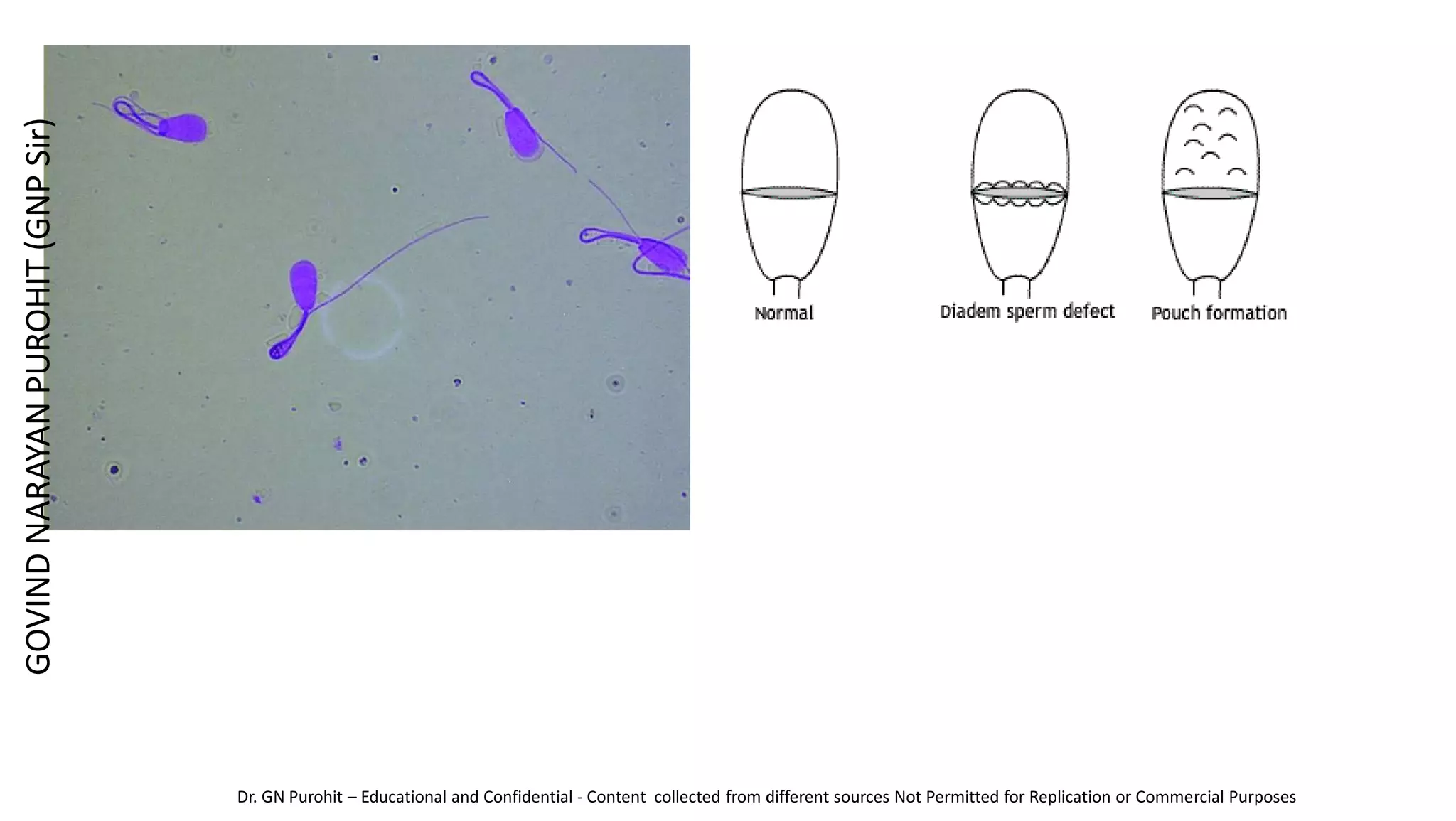 GOVIND
NARAYAN
PUROHIT
(GNP
Sir)
Dr. GN Purohit – Educational and Confidential - Content collected from different sources Not Permitted for Replication or Commercial Purposes
 