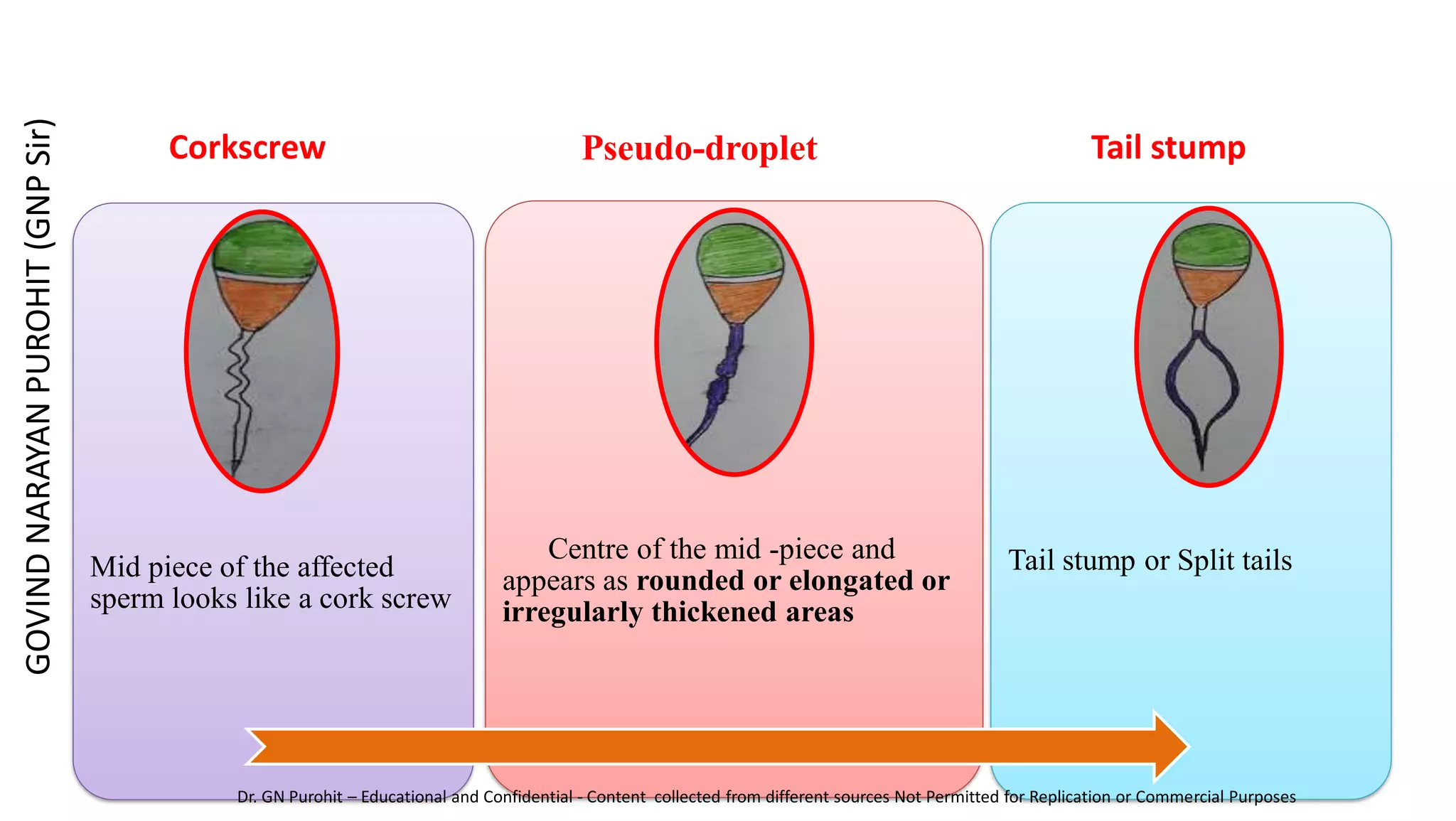 Mid piece of the affected
sperm looks like a cork screw
Centre of the mid -piece and
appears as rounded or elongated or
irregularly thickened areas
Tail stump or Split tails
Pseudo-droplet Tail stump
Corkscrew
GOVIND
NARAYAN
PUROHIT
(GNP
Sir)
Dr. GN Purohit – Educational and Confidential - Content collected from different sources Not Permitted for Replication or Commercial Purposes
 