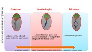 Mid piece of the affected
sperm looks like a cork screw
Centre of the mid -piece and
appears as rounded or elongated or
irregularly thickened areas
Tail stump or Split tails
Pseudo-droplet Tail stump
Corkscrew
GOVIND
NARAYAN
PUROHIT
(GNP
Sir)
Dr. GN Purohit – Educational and Confidential - Content collected from different sources Not Permitted for Replication or Commercial Purposes
 