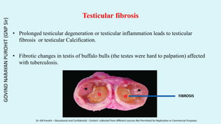 Testicular fibrosis
• Prolonged testicular degeneration or testicular inflammation leads to testicular
fibrosis or testicular Calcification.
• Fibrotic changes in testis of buffalo bulls (the testes were hard to palpation) affected
with tuberculosis.
FIBROSIS
GOVIND
NARAYAN
PUROHIT
(GNP
Sir)
Dr. GN Purohit – Educational and Confidential - Content collected from different sources Not Permitted for Replication or Commercial Purposes
 