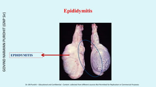 Epididymitis
EPDIDYMITIS
GOVIND
NARAYAN
PUROHIT
(GNP
Sir)
Dr. GN Purohit – Educational and Confidential - Content collected from different sources Not Permitted for Replication or Commercial Purposes
 