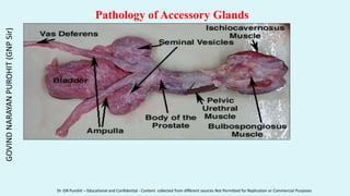 Pathology of Accessory Glands
GOVIND
NARAYAN
PUROHIT
(GNP
Sir)
Dr. GN Purohit – Educational and Confidential - Content collected from different sources Not Permitted for Replication or Commercial Purposes
 