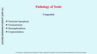 Pathology of Testis
Congenital
 Testicular hypoplasia
 Freemartinism
 Hermaphroditism
 Cryptorchidism
GOVIND
NARAYAN
PUROHIT
(GNP
Sir)
Dr. GN Purohit – Educational and Confidential - Content collected from different sources Not Permitted for Replication or Commercial Purposes
 