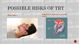 Sleep apnea
Stimulation of growth of prostate
cancer
 