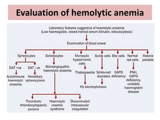 Evaluation of hemolytic anemia
 